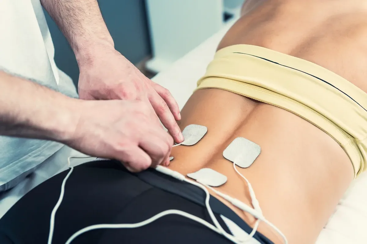 Electrical stimulation therapy applied to a patient's lower back